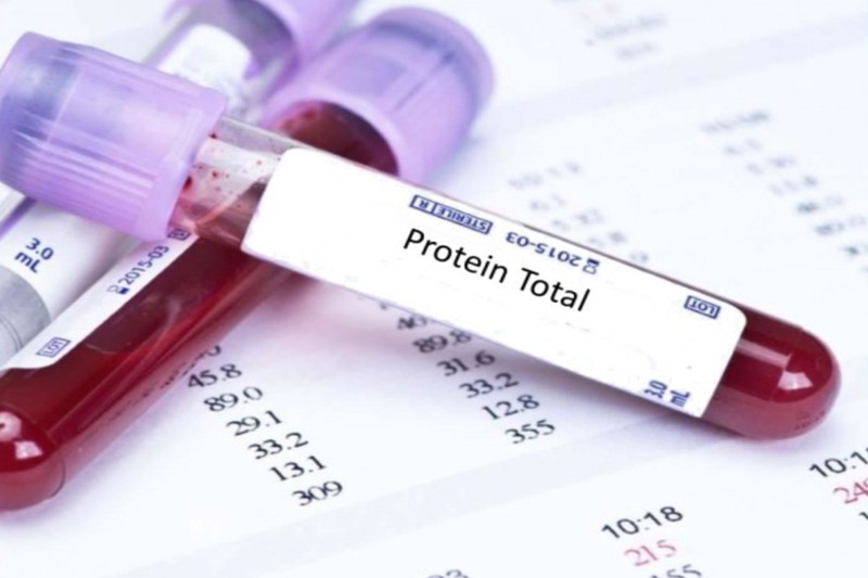 Xét nghiệm protein để đánh giá tình trạng sức khỏe