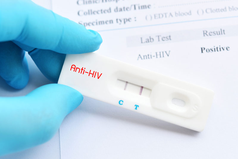 Phương pháp xét nghiệm HIV có thể phân thành nhiều loại