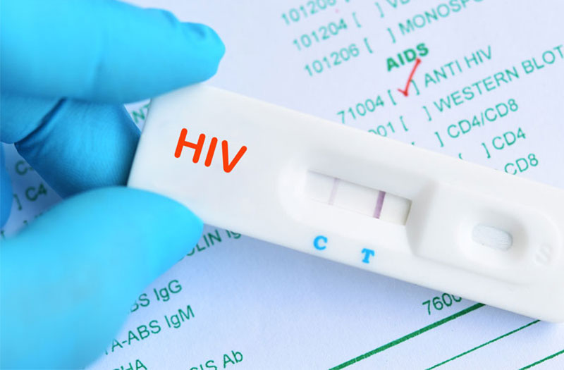 Nên làm xét nghiệm HIV sớm khi có nghi ngờ nhiễm bệnh