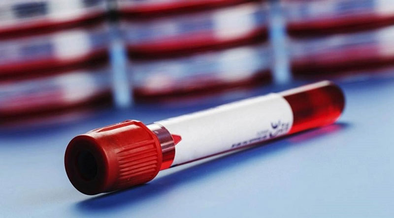 Nhóm máu A- có thể truyền cho nhiều nhóm máu khác hơn