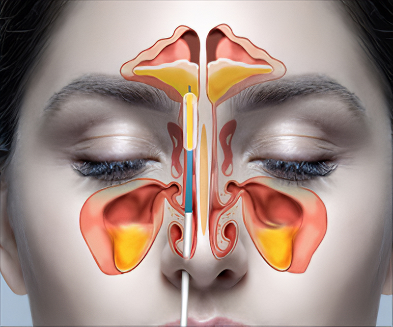 Hình ảnh minh họa vị trí của các xoang mũi