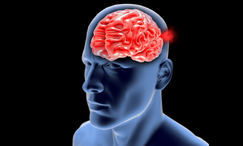 Viêm màng não là một trong các biến chứng tại não bộ