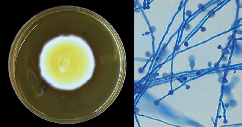 Hình: Blastomyces dermatitidis trên Sabouraud Dextrose Agar (SDA) sau 7 ngày ủ ở 30 ° C và bào tử nấm Blastomyces dermatitidis