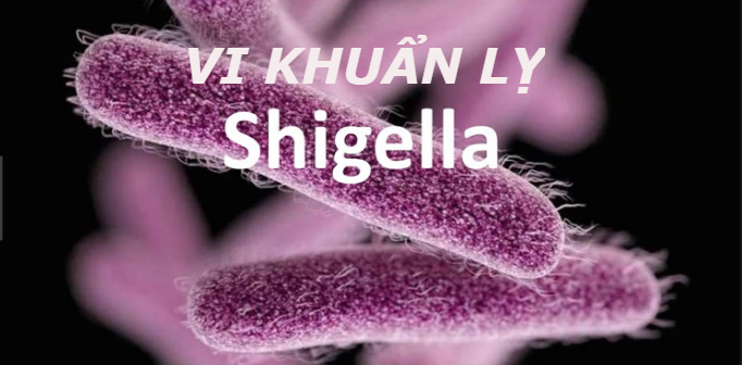 Trực khuẩn Shigella là nguyên nhân gây ra bệnh lỵ trực trùng