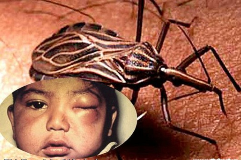Bệnh Chagas xuất hiện khi bị bọ rệp đốt, khi chất tiết mang mầm bệnh của bọ rệp tiếp xúc với kết mạc