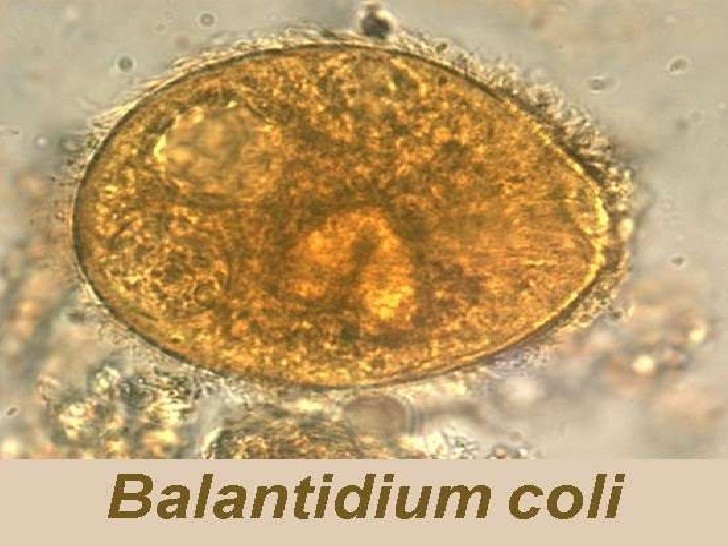 Balantidium là ký sinh trùng ký sinh và gây bệnh tại ruột, thường gặp tại manh tràng và đại tràng