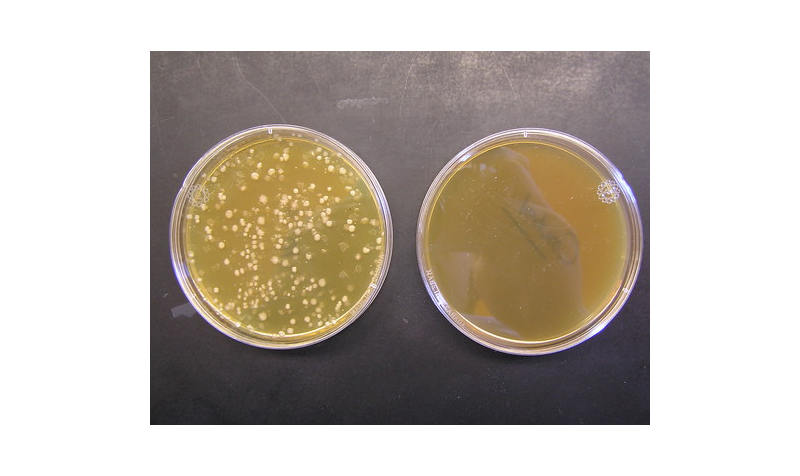 Nuôi cấy vi khuẩn phân lập được Brucella trong bệnh phẩm là tiêu chuẩn vàng để chẩn đoán bệnh