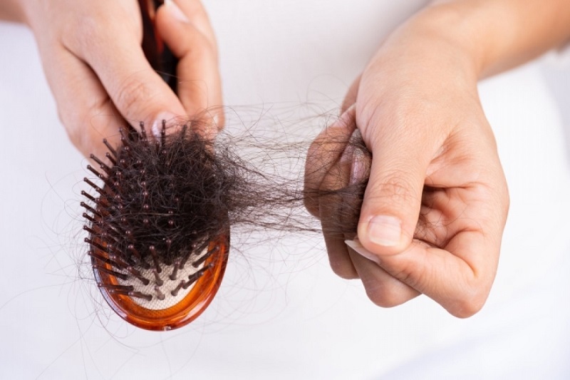 Rụng tóc là tình trạng người bệnh thực hiện hoá trị có thể gặp phải
